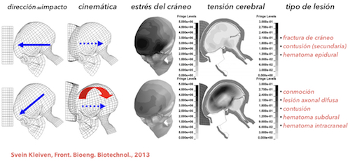 biomecanica-del-traumatismo-craneal