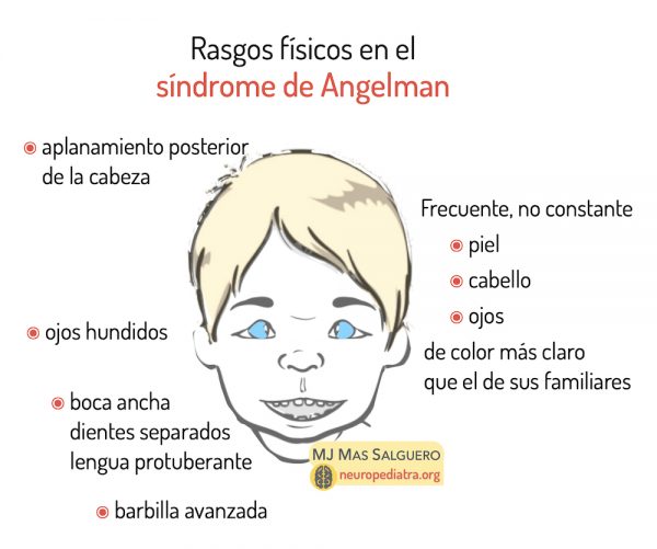 Ladder Angelman Síndrome de Angelman - neuronas en crecimiento